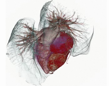 发现影响心脏老化的新基因