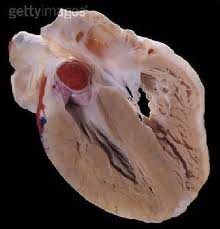  奈西立肽治疗急性心衰的喜与忧