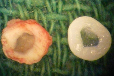 From left, a natural rat IVD compared with a tissue engineered IVD.