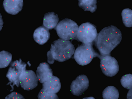 成功修正凝血缺陷的“锌指核酸酶”技术