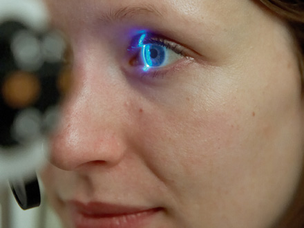 PLoS One：视神经衰弱所引发青光眼与基因变异有关