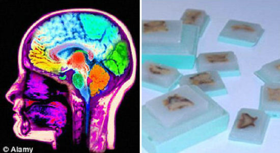 英科学家呼吁大脑捐献帮助对抗痴呆症研究