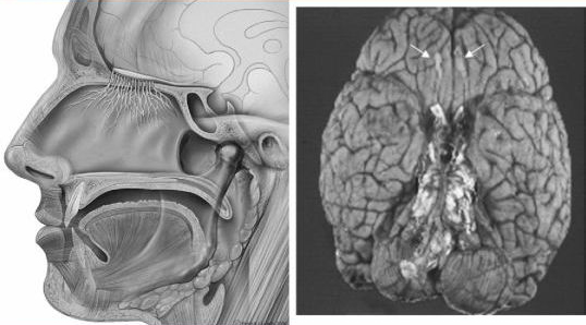 Brain：嗅觉检查有助于诊断帕金森氏症