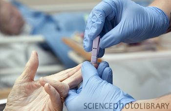 Diabetes Care:类黄酮可降低Ⅱ型糖尿病患者心脏病风险