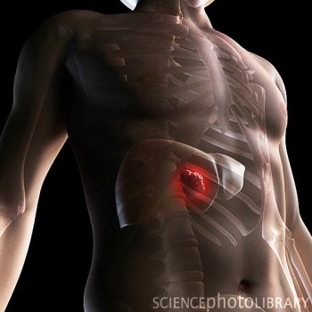 防癌早知道——警惕癌症发生的早期征兆 肝癌