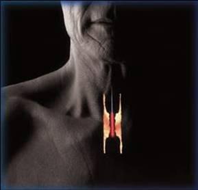 防癌早知道——警惕癌症发生的早期征兆 食道癌