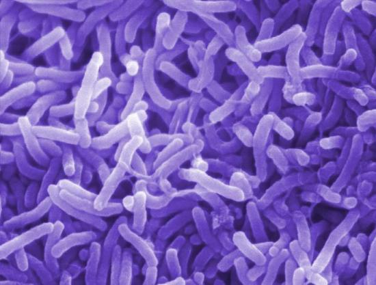 霍乱弧菌利用“毒匕首”杀微生物对手