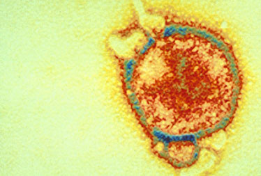 Hendra Virus