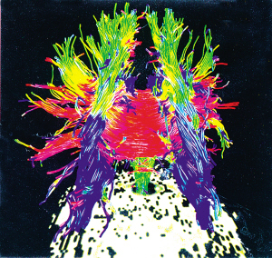 潮人与宅男的性格区别：脑白质回路不同