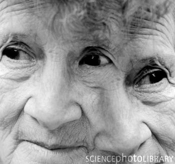 某些“精神病基因”或是人类进化优势