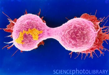 美解开癌细胞低氧低糖时如何合成脂肪分裂难题