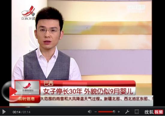 巴西30岁女子智商外貌似9岁婴儿 甲状腺激素惹的祸