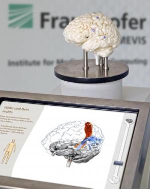 This is the Fraunhofer MEVIS neuro exhibit.