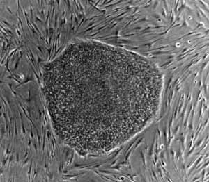 Stem cells