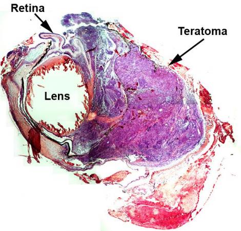 Histological staining of a teratoma containing Rho-/- eye at 21 days post-injection of a heterogeneous population of SSEA1-containing D33 differentiated cells.
