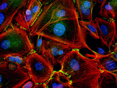 Hydrogen peroxide key to skin wound healing 