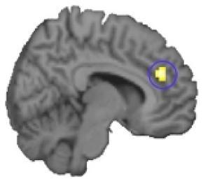 Region in the prefrontal cortex important for perceptual learning.