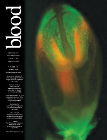 《血液》撤销一篇干细胞研究论文