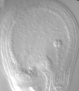 Young plant embryo (8-cell stage) in a developing seed of Arabidopsis thaliana (thale cress). 