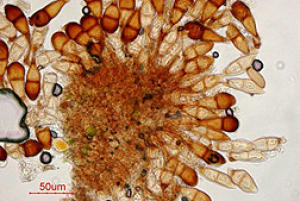 Micrograph of Puccinia graminis, the fungus that causes wheat stem rust.