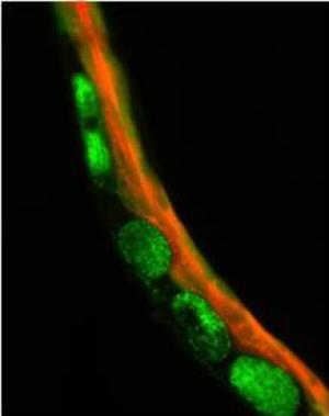 Heme (red) is eaten by an pregnant worm.