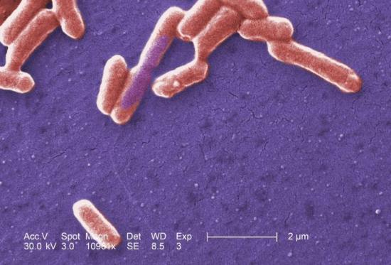 Colorized scanning electron micrograph depicted a number of Gram-negative Escherichia coli bacteria. Researchers used an experimental model system to study the evolution of a gene conferring resistance to the antibiotic cefotaxime in bacteria. 