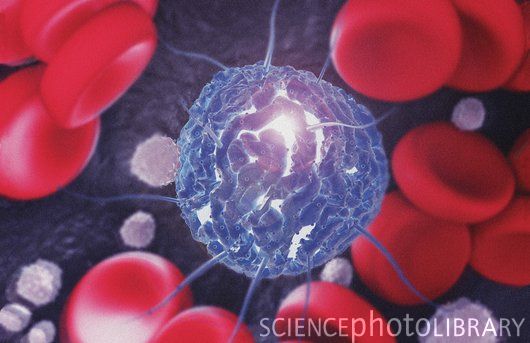 PNAS：修改血液干细胞基因可治疗黑色素瘤
