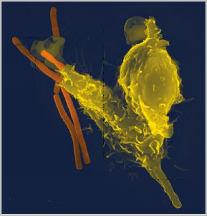 Pictured:A false-colored yellow neutrophil, one of several types of white blood cells that comprise the body's immune system, engulfs anthrax bacteria (orange).
