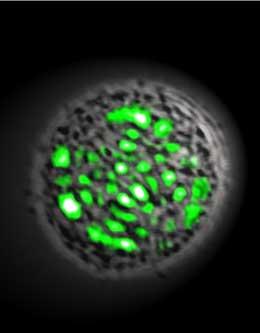 Microscope image of a living laser in action.