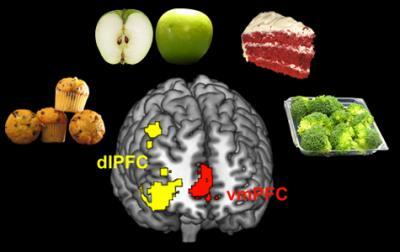 the dorsolateral prefrontal cortex (dlPFC) 