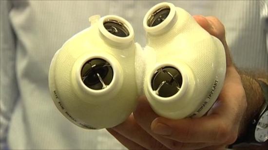 新的塑料心脏装置